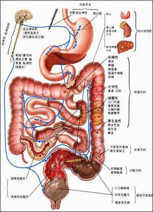 <strong>慢性腹泻的病因有哪些</strong>